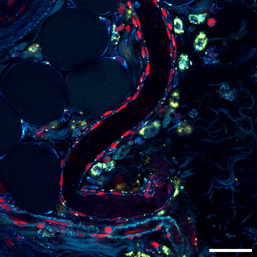 Schistosoma
