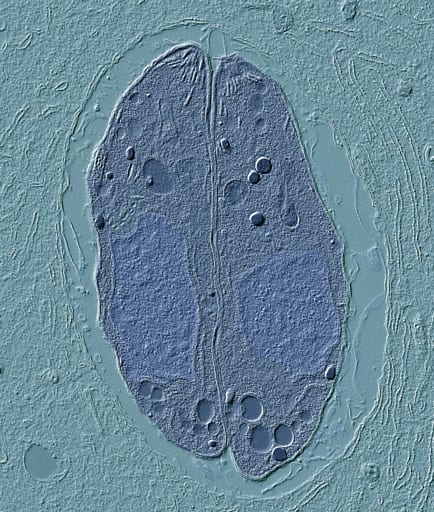 A micrograph of Toxoplasma gondii, a single-celled parasite that infects many animals, including humans.