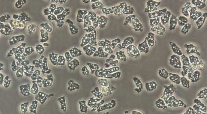 Acanthamoeba