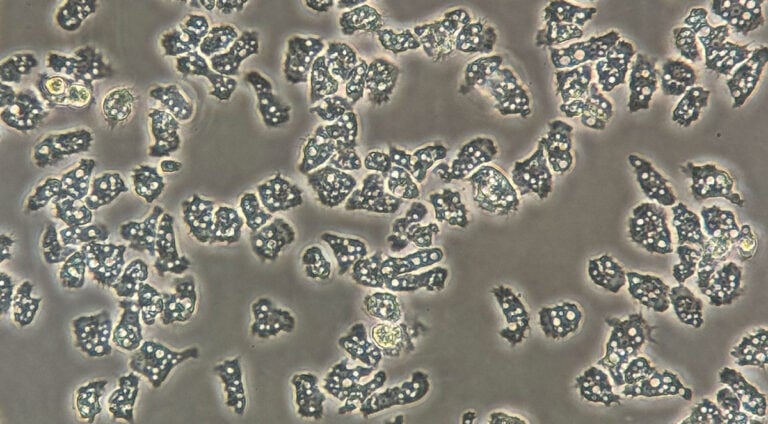 Eye-eating amoeba resists treatment — understanding its biochemistry could help