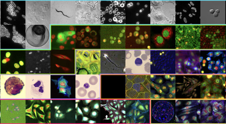 CHAMMI-75: Finding common ground across millions of biology images