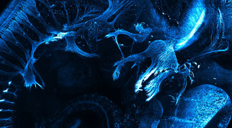 Fluorescence Imaging Explained: Microscopic Life in Many Colors