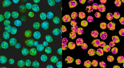 neutrophils-omi-featured