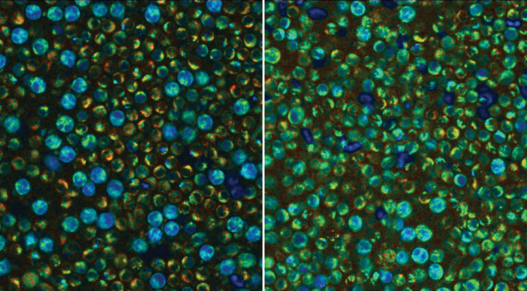 New imaging technique reveals the inner workings of immune cells