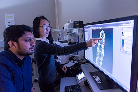 Jiarong Gao points at the schistosome brain in an adult worm.