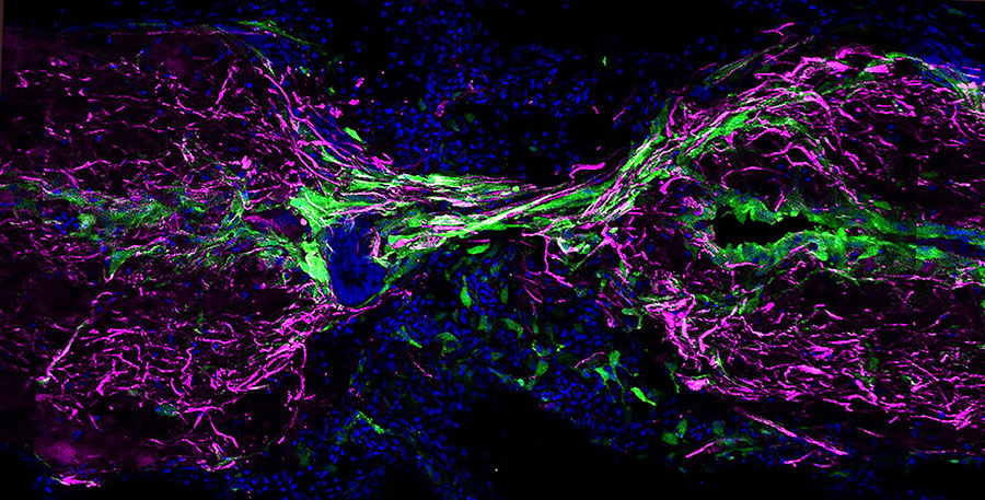 Zebrafish spinal cord