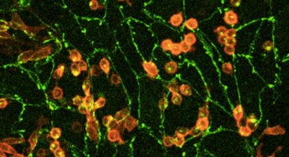 Wisconsin scientists find genetic recipe to turn stem cells to blood