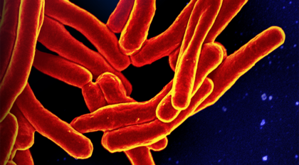 Tubercolosis